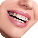 real.braces.camera.photo.editor