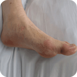 com.StatesApps.RemediesFootGout