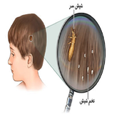 ir.moghabele.ba.shepesh.d