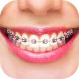 com.thalia.fake.braces.photo.editor