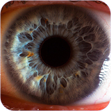 zemestan.bimarihayecheshm