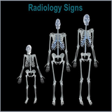 com.androidmedics.radiologysigns