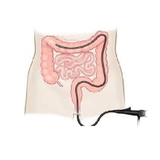 appinventor.ai_raziehghafouri.colonoscopy_copy