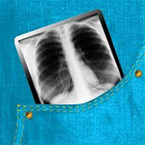 com.appybuilder.maxj965.Easy_Chest_XRay