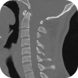 net.mdtoolkit.ctcervicalspine
