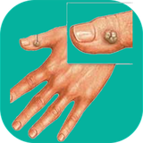 com.sra_ht.bemarrezege