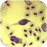 eshto.angalvabimarihayean