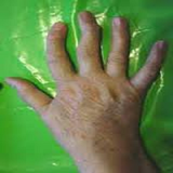 ir.artroz.va.darman.an.d