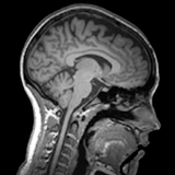 gov.nih.nibib.imagingapp