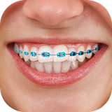 com.picfix.teethbraces