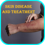 com.causes.symptoms.skin.disease