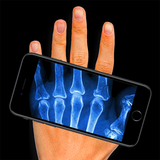 us.INFLU.Xray
