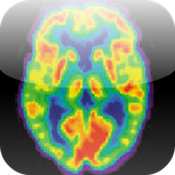 mdtoolkit.radiologycorenuclearmedicine