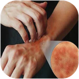 shafagh.bimarihayeposti