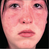 com.kmzfvco.bimaripoosti