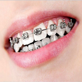 com.cintamiapps.braces