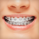 com.best.photo.app.braces