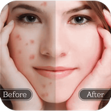 com.taptarin.treatacne