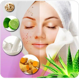com.brooztarin.acne