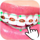 com.insasofttech.braces.photoeditor