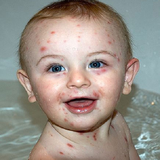 ir.peshgere.va.darmane.able.morghan