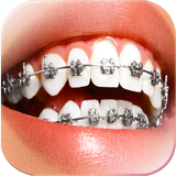 com.braces.selfie.camera.photo.editor_sticker